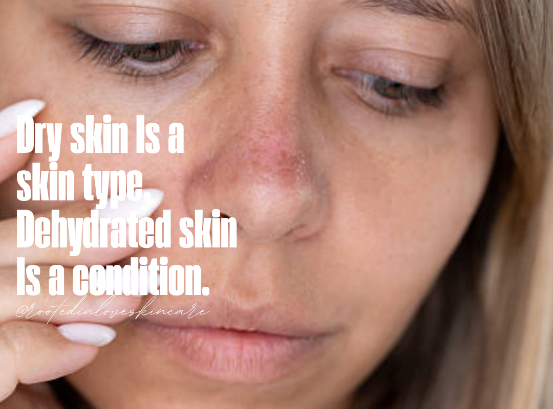 6 Signs Your Skin Is Dehydrated (Not Dry)